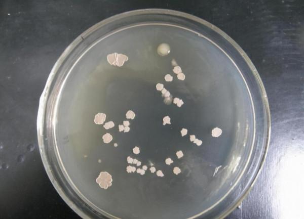 為永保青春，科學家與女模一起注射350萬年前細菌，後來如何？