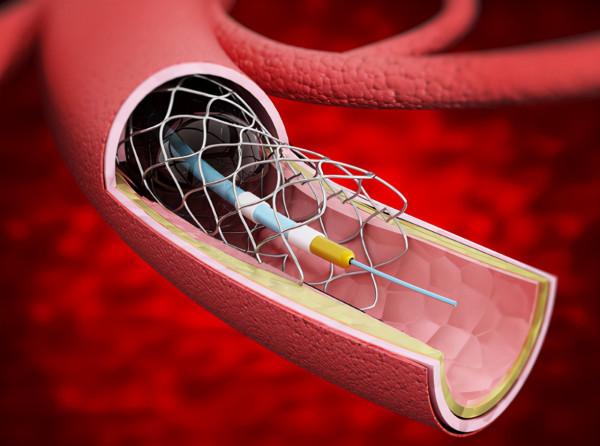 “無效治療”是存在的,醫生:很多手術或無需做,很多藥或不用吃 “無效治療”是存在的,醫生:很多手術或無需做,很多藥或不用吃