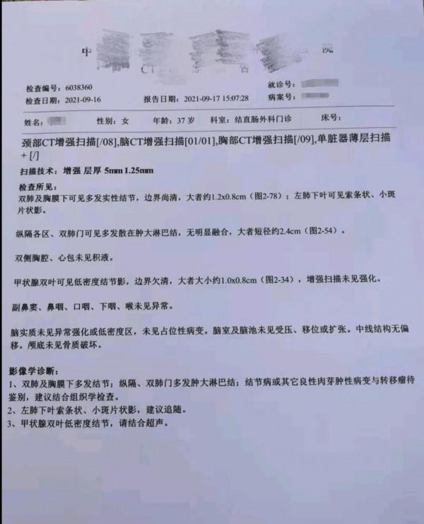 劉懿博士說肺癌（二六亖八）37歲女士咳嗽頻繁，擔心是晚期肺癌