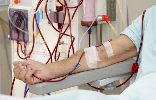 3箇中成藥,多靶點改善糖尿病微血管病變,減少尿蛋白保護腎功能 3箇中成藥,多靶點改善糖尿病微血管病變,減少尿蛋白保護腎功能