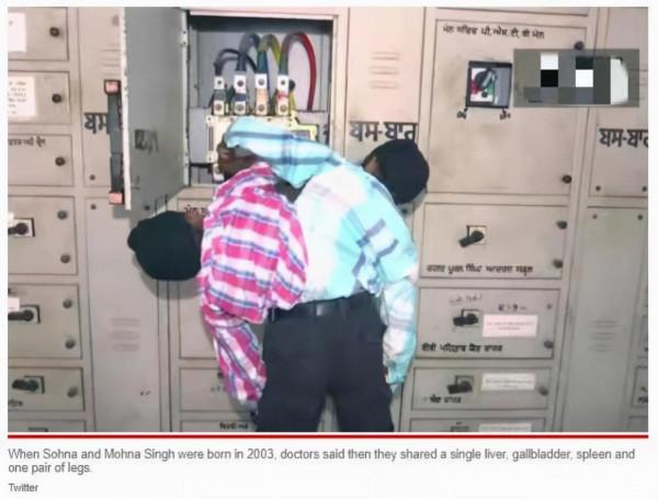 印度被遺棄連體雙胞胎找到“夢想工作”