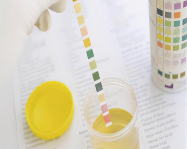 國產降壓新藥阿利沙坦酯,保護心腎還可以降尿酸,幾乎不影響肝腎 國產降壓新藥阿利沙坦酯,保護心腎還可以降尿酸,幾乎不影響肝腎