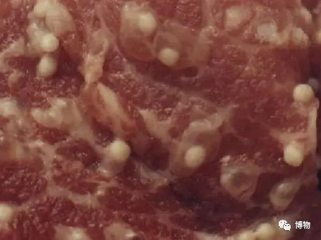 男子半夜突發羊角風，居然是因為腦子裡有蟲？