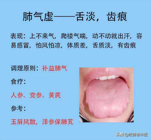 五臟常見的8種虛,臨床的表現和對應解決方法分享 五臟常見的8種虛,臨床的表現和對應解決方法分享