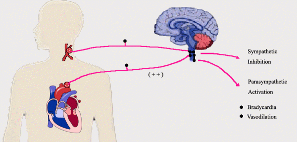 有種心律失常叫「衣領綜合徵」,穿高領、系圍巾都要小心了 有種心律失常叫「衣領綜合徵」,穿高領、系圍巾都要小心了