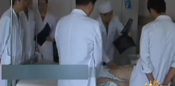 2006年雲南一男子體內出現大量鋼針危及生命，始作俑者竟是他自己