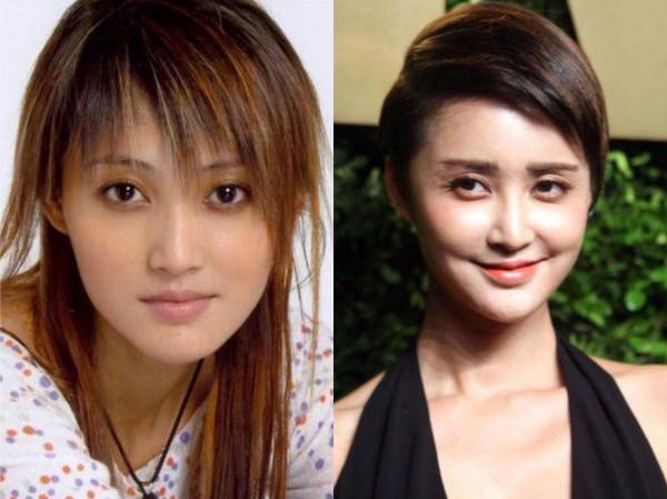 凹凸不平、眼睛擠成一條縫,“發麵饅頭”臉毀了多少高顏值明星? 凹凸不平、眼睛擠成一條縫,“發麵饅頭”臉毀了多少高顏值明星?