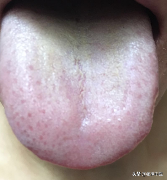 胃痛、胃脹、胃輕癱，糖尿病胃腸病變的中醫治療