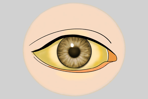 觀面相,知疾病?面部出現4種情況,別忽視,及時做個檢查 觀面相,知疾病?面部出現4種情況,別忽視,及時做個檢查