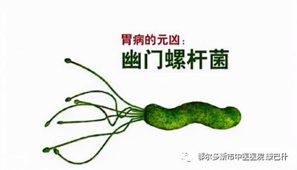 科普 | 診斷早期胃癌的利器——胃功能三項