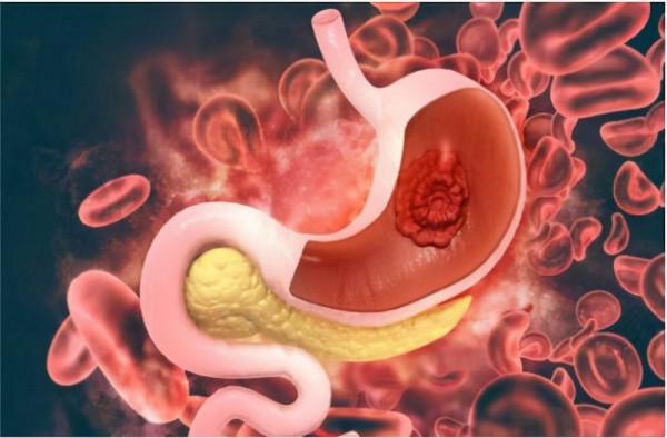 人到中年,4種症狀別“硬扛”,超過一段時間不愈,要重視 人到中年,4種症狀別“硬扛”,超過一段時間不愈,要重視