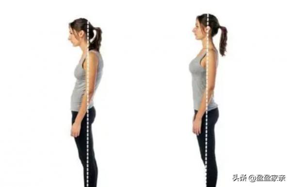 解決含胸駝背的好方法，提高自己的氣質只需幾個動作