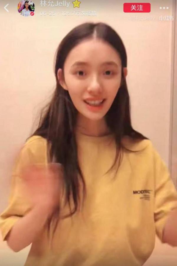 瘦成“紙片人”的5位明星，各有各的辛酸，混娛樂圈怎麼那麼難