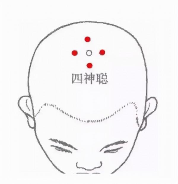 《疏調學術論壇》針灸-疏調氣機防治不寐(肝火擾心證) 《疏調學術論壇》針灸-疏調氣機防治不寐(肝火擾心證)