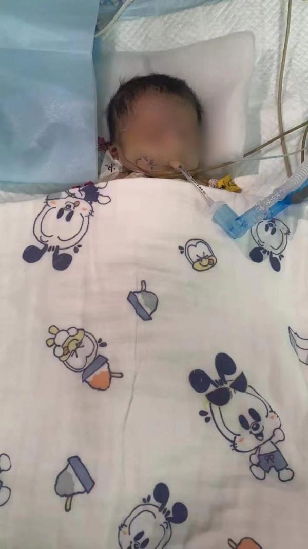 驚心動魄！嚴重先心病女嬰，如何成功完成“針尖刻字”般的手術