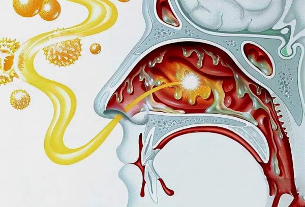 有人鼻子裡面竟然“發黴”了？嚴重的可能要命