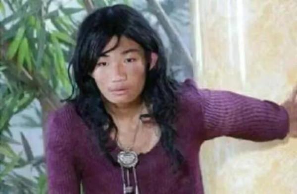 我被父母養成河南第一懶人：7歲不會走路，吃飯靠喂23歲自己餓死