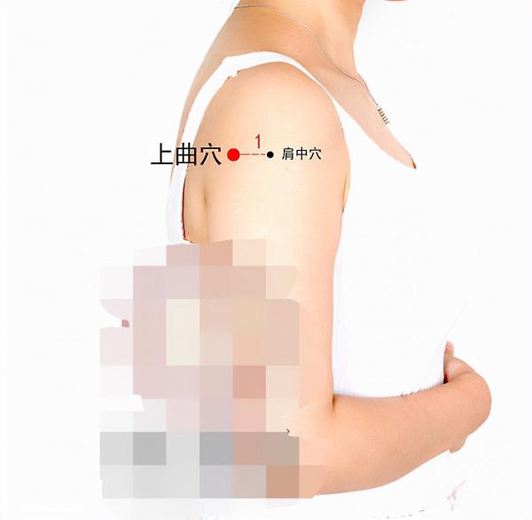 中醫針灸肩部疾病處方1 中醫針灸肩部疾病處方1