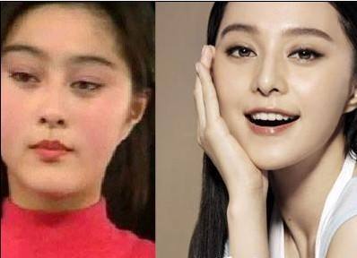 內娛“假鼻子”大PK，誰的假到逆天，誰的越整越殘？