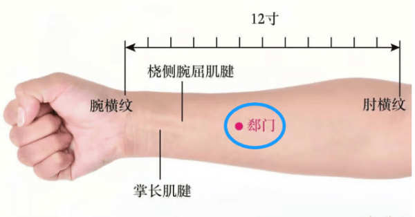 郄門穴&mdash;心臟病突發時的&OpenCurlyDoubleQuote;救急穴位&rdquo;