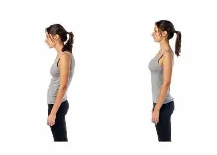 「健康科普」 後仰挺胸能治駝背嗎？真相為你揭曉