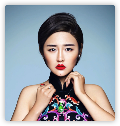 本山傳媒嬌嬌自曝整容，曬術後照被指認不出，多次割眼皮腫脹明顯