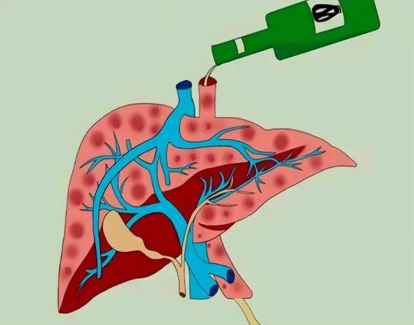 喜歡喝酒的人，身體反覆有4種情況，酒精肝或已找上門，趕緊戒