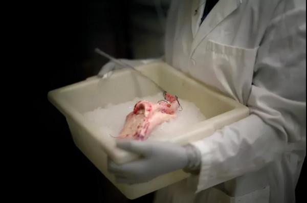 重磅!世界首例豬腎臟移植人體手術成功!目前無排斥反應 重磅!世界首例豬腎臟移植人體手術成功!目前無排斥反應