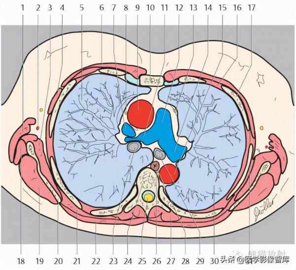 CT斷層解剖圖譜最全總結「推薦收藏」 CT斷層解剖圖譜最全總結「推薦收藏」