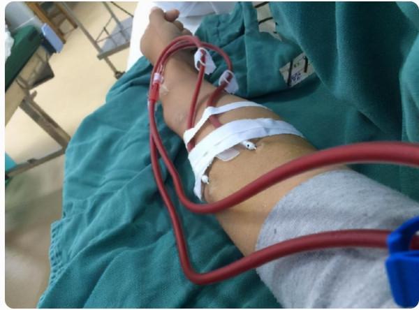 40歲男子患尿毒症，依靠透析維持生命：後悔年輕時太無知