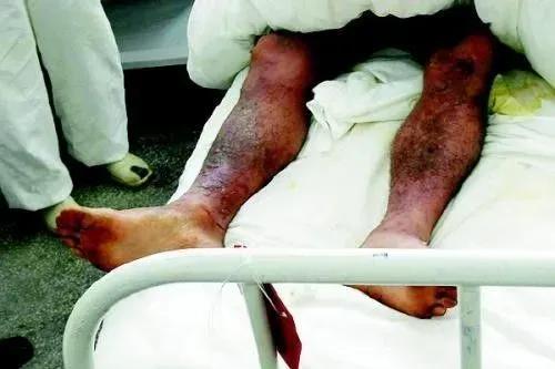 化學武器，淡淡的香味之下是一個個無形“殺手”