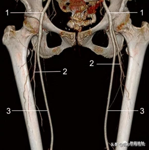 CT斷層解剖圖譜最全總結「推薦收藏」 CT斷層解剖圖譜最全總結「推薦收藏」
