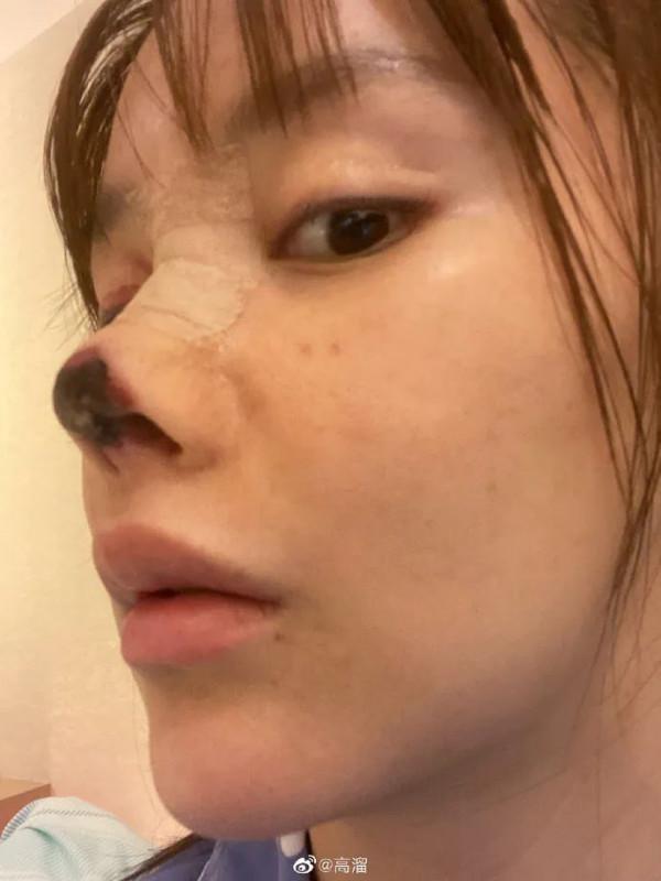 內娛“假鼻子”大PK，誰的假到逆天，誰的越整越殘？