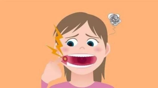 這種口腔潰瘍,真少見! 這種口腔潰瘍,真少見!