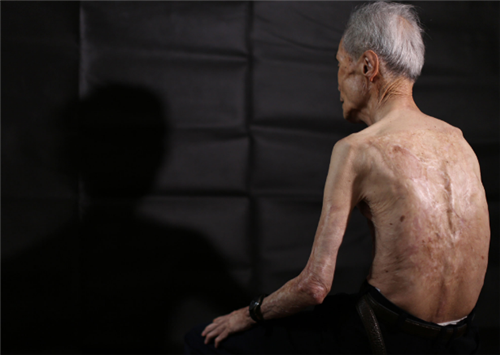 日本原子彈爆炸後的倖存者,面對採訪:別製造我這樣的“怪物”了 日本原子彈爆炸後的倖存者,面對採訪:別製造我這樣的“怪物”了