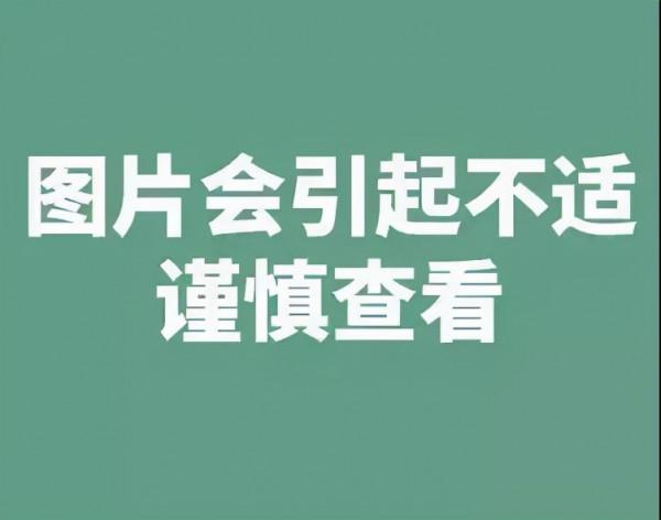 攻克又一難關！多學科協作全盆腔臟器切除術為患者迎來新希望