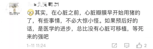 全球首例！美國57歲男子成功移植轉基因「豬心」，異種移植創奇蹟