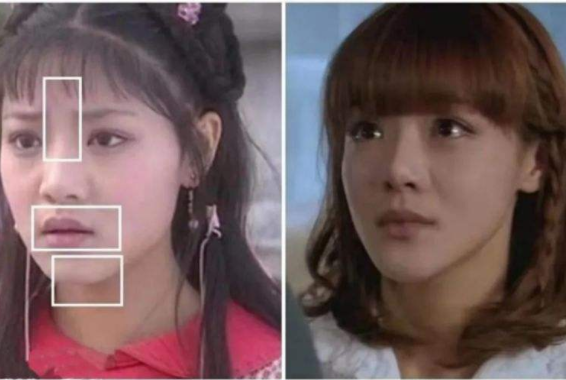 內娛“假鼻子”大PK，誰的假到逆天，誰的越整越殘？