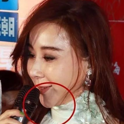 臉僵如石、腫成發麵饅頭，這7位女星動臉後變“災難現場”