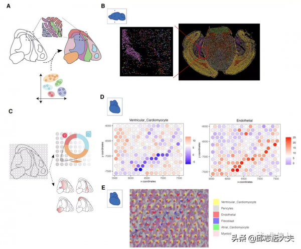 咱就是說，看完這篇文章還不懂空間轉錄組資料分析？