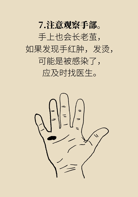 長了雞眼和老繭怎麼辦？這份防治指南請收好