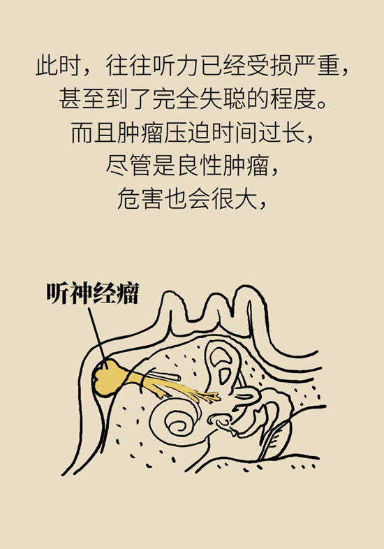 耳鳴是人老了聽力不行了?錯,可能藏著個大病 耳鳴是人老了聽力不行了?錯,可能藏著個大病