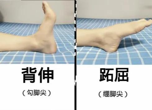 膝關節術後股四頭肌康復訓練