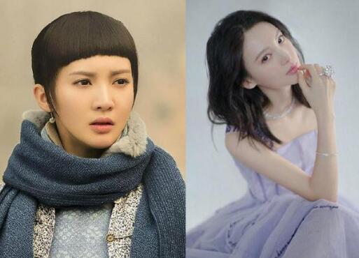 整容界的天花板!盤點靠整容實現逆天改命的明星 整容界的天花板!盤點靠整容實現逆天改命的明星