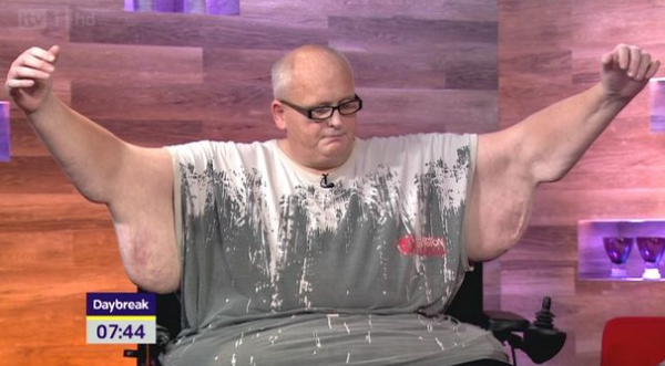 最胖的人能有多胖?住院三年後醫院告知:火化得去屠宰場 最胖的人能有多胖?住院三年後醫院告知:火化得去屠宰場