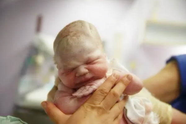 同是孕晚期,孕38周和孕40周分娩的娃無差別?三個方面區別很明顯 同是孕晚期,孕38周和孕40周分娩的娃無差別?三個方面區別很明顯