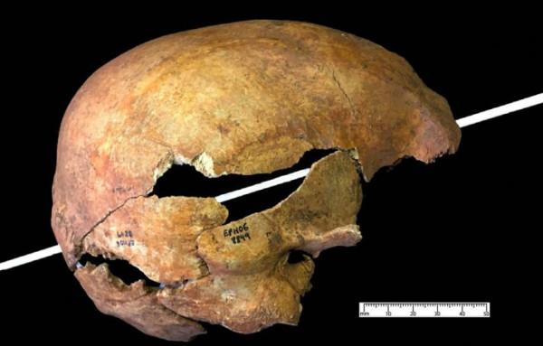 從解剖學的角度來說,椰子硬和人類的頭顱,究竟誰更硬? 從解剖學的角度來說,椰子硬和人類的頭顱,究竟誰更硬?