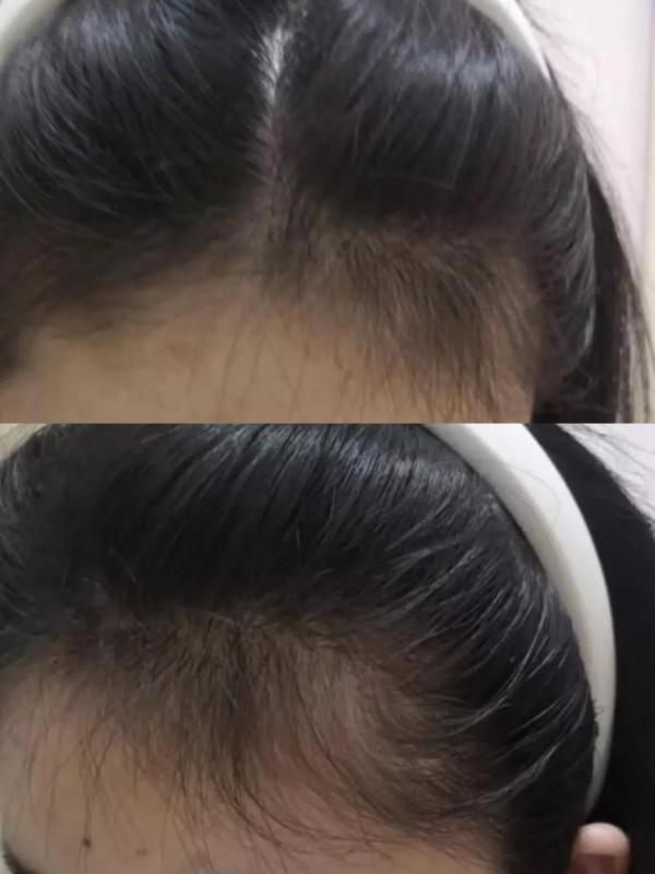 趙露思同款護髮心得