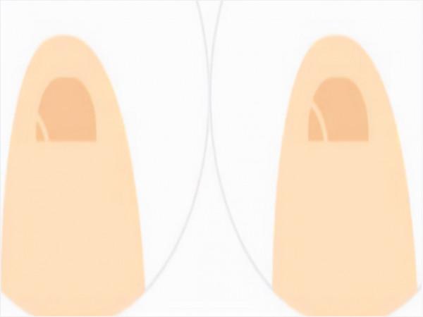 那些小腳趾指甲分成兩瓣的人,到底是什麼來歷?你的指甲是這樣嗎 那些小腳趾指甲分成兩瓣的人,到底是什麼來歷?你的指甲是這樣嗎