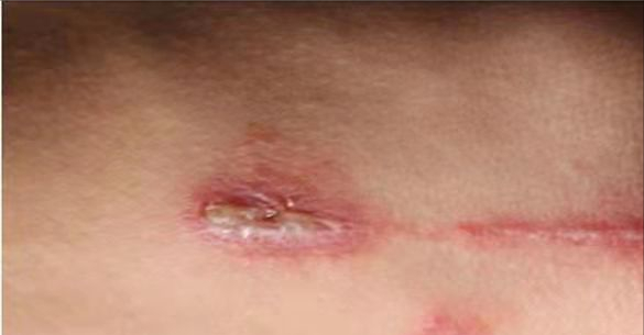 你家裡出現過這兩種昆蟲嗎？你覺得哪種更讓你毛骨悚然？